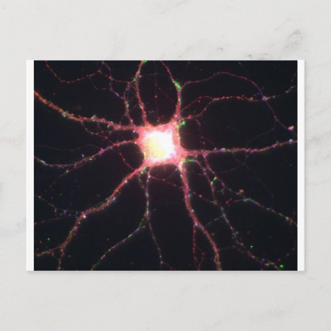 Carte Postale neurones hippocampaux 2 (Devant)