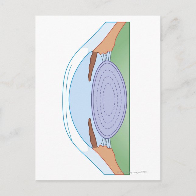 Carte Postale Oeil après chirurgie correctionnelle (Devant)