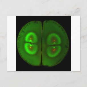 Carte Postale OEuf de grenouille fertilisé