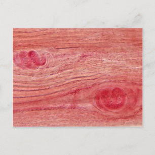 Carte Postale Parasite Trichinella spiralis