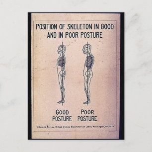 Carte Postale Position Du Squelette En Bonne Et En Mauvaise Posi