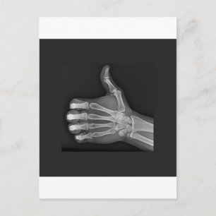 Carte Postale Pouce vers le haut