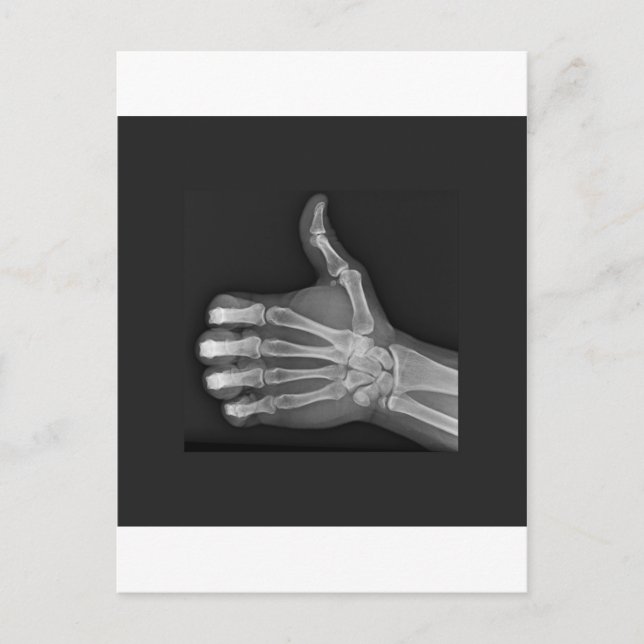 Carte Postale Pouce vers le haut (Devant)