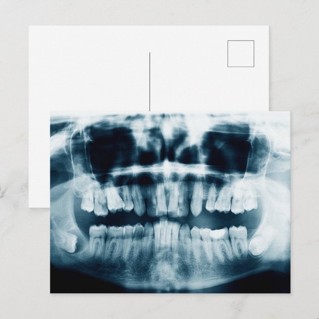 Carte Postale Rayon X des dents (Devant / Derrière)