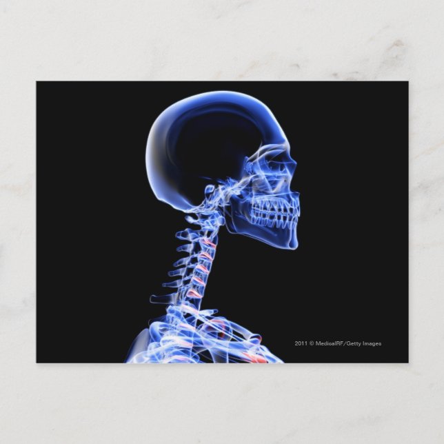 Carte Postale Rayon X des os dans le cou (Devant)