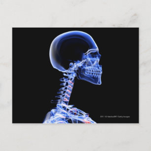 Carte Postale Rayon X des os dans le cou