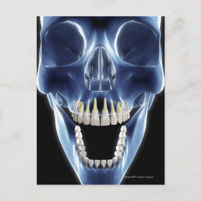 Carte Postale Regarder les dents humaines par rayons X (Devant)