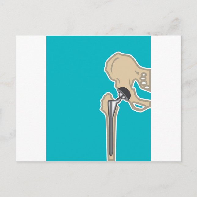 Carte Postale Remplacement du joint de la hanche (Devant)