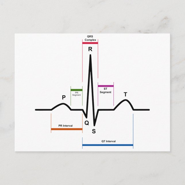 Carte Postale Rythme sinus dans un diagramme ECG d'électrocardio (Devant)