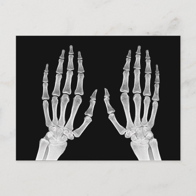 Carte Postale Skeleton Hands Xray Photo Anatomie humaine photo (Devant)