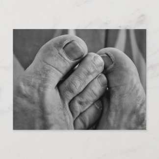 Carte Postale Ugly Feet