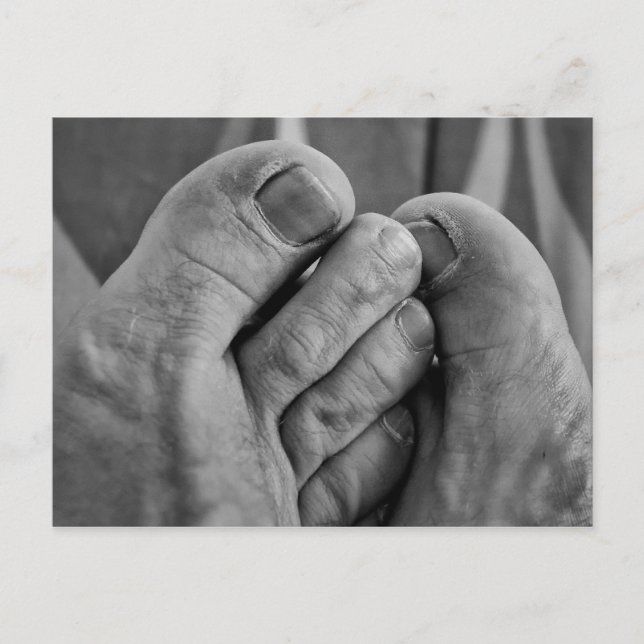 Carte Postale Ugly Feet (Devant)