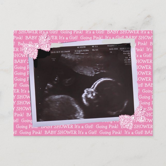 Carte Postale Ultrasound Cture Baby Shower Piwer Postcard (Devant)