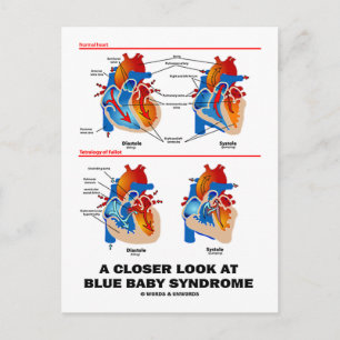 Carte Postale Un Regard Plus Près Sur Le Syndrome Bébé Bleu (Coe