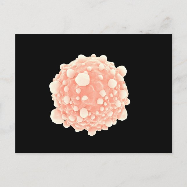 Carte Postale Vue Microscopique De La Cellule Cancer Pancréatiqu (Devant)