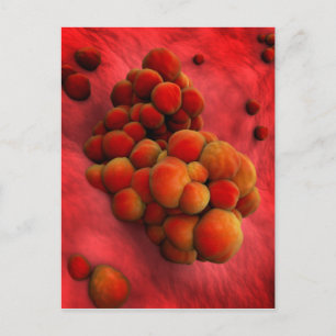 Carte Postale Vue Microscopique De La Tumeur 2