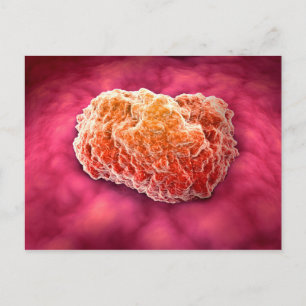 Carte Postale Vue Microscopique De La Tumeur 3