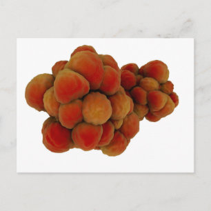 Carte Postale Vue Microscopique De La Tumeur 4