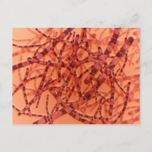 Carte Postale Vue Microscopique De L'Anthrax 3