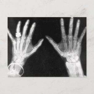 Carte Postale X-Ray Skeleton Mains et bijoux - B&W