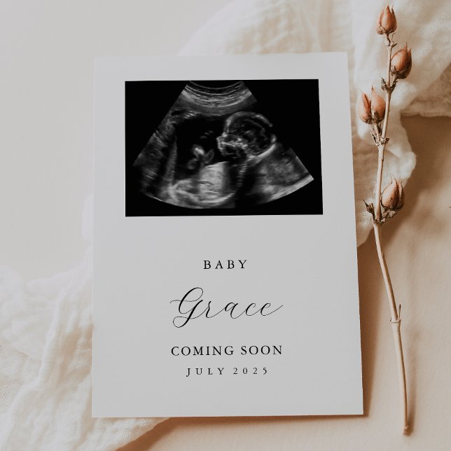 Carte simple Faire-part photo Ultrasound (Créateur téléchargé)