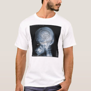 Case Study: Roto Tom Player - Roto Tom Drums T-Shirt