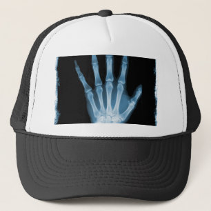 Casquette Main bleue de squelette de rayon X