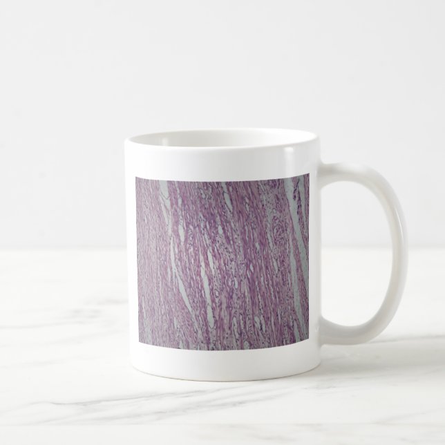 Cells of human uterus tissue with inoffensive tumo coffee mug (Right)