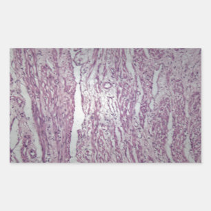 Cells of human uterus tissue with inoffensive tumo sticker