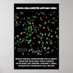 Cellules neuronales infectées avec Poster Zika par