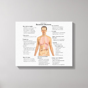 Chart of the bacterial infections in Humans Canvas Print