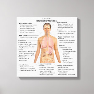 Chart of the bacterial infections in Humans Canvas Print