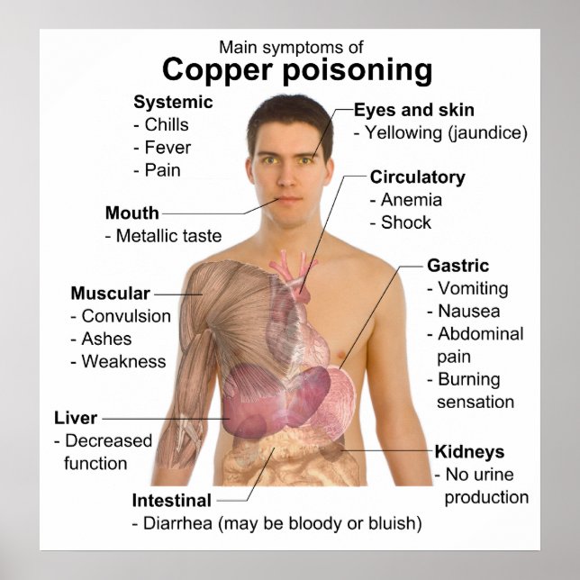 Chart of the Main Symptoms of Copper Poisoning (Front)