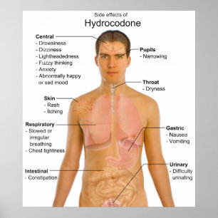 Chart of the Side Effects of Opioid Hydrocodone