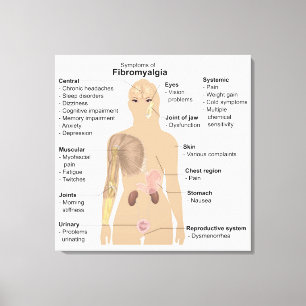 Chart Signs Symptoms Fibromyalgia Canvas Print