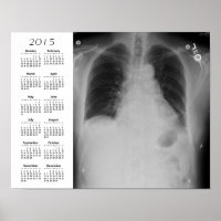 Chest X Calendrier Ray ~ Poster