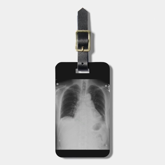Chest X Ray ~ Luggage tag (Front Vertical)
