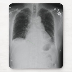 Chest X-Ray ~ mousepad