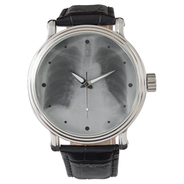 Chest X Ray ~ watch (Front)