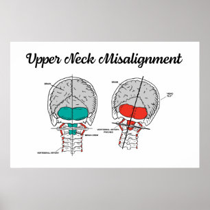 Chiropractic Upper Cervical Poster