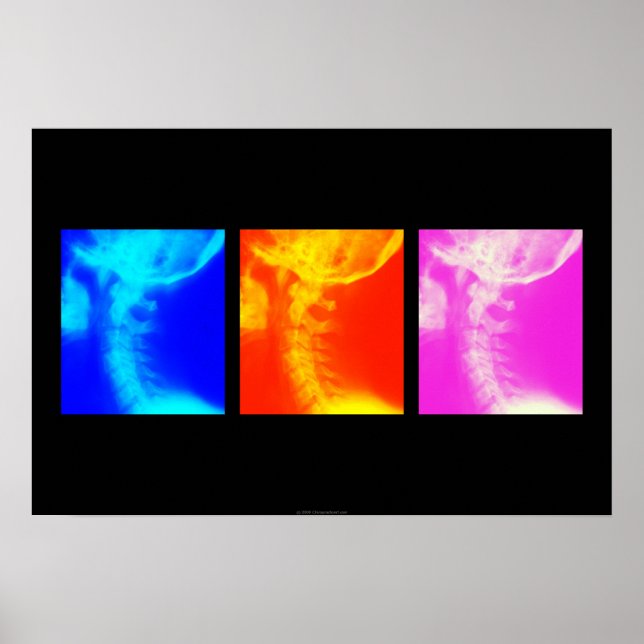 Chiropratique à rayons X cervicaux affiche 1 (Devant)
