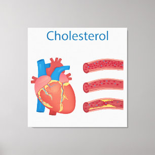 Cholesterol Canvas Print