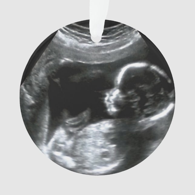 Christmas Baby Sonogram Picture Gift Ornament (Front)