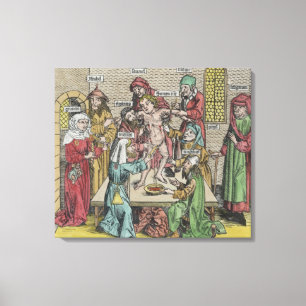 Circumcision Canvas Print