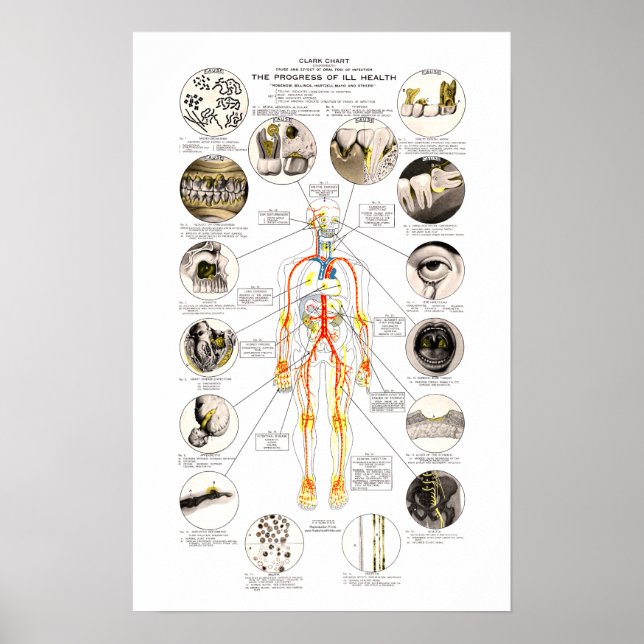 Clark Dental Health Chart for Dentist (Front)