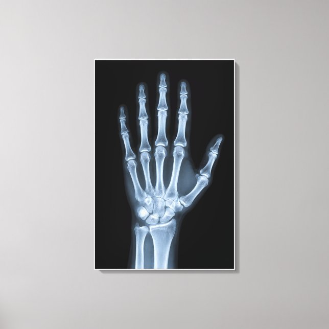 Clinical X-Ray Hand Canvas Print (Front)