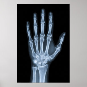 Clinical X-Ray Hand Poster
