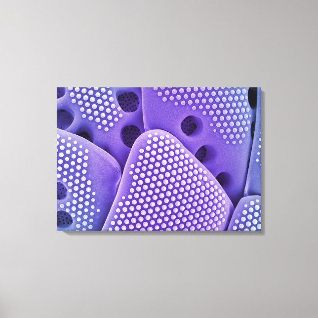 Close of Diatom frustules (Mlychenensis) Canvas Print (Front)