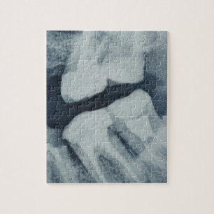 Close-up of a dental X-Ray Jigsaw Puzzle