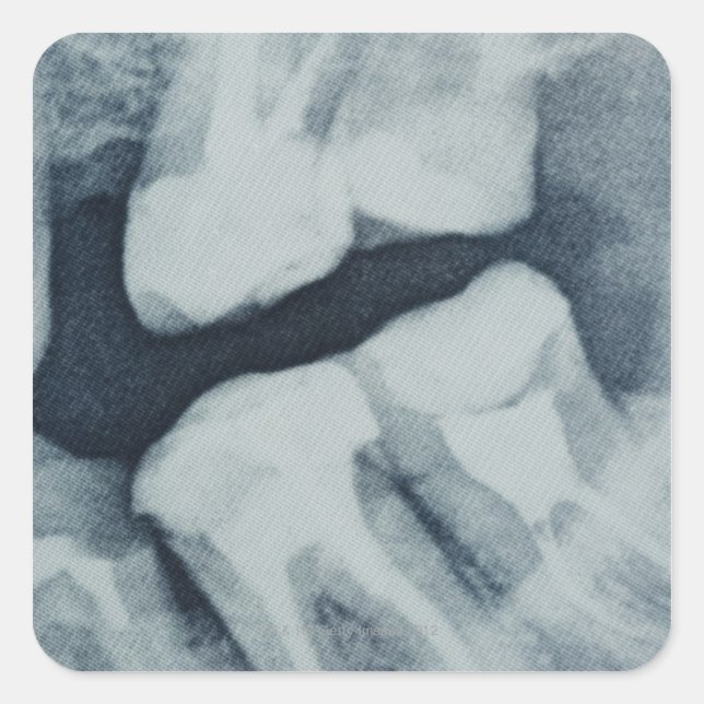 Close-up of a dental X-Ray Square Sticker (Front)